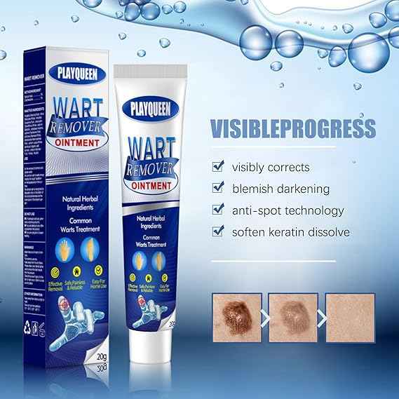 Wart Remover Ointment
